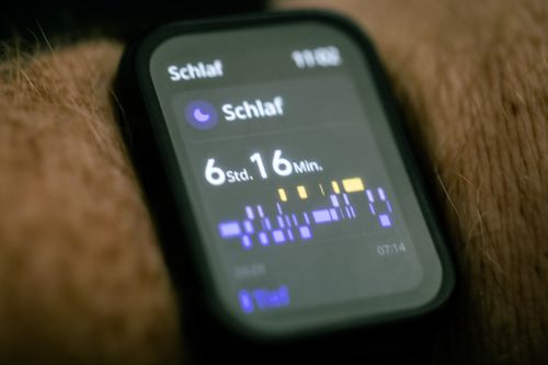 Applikationen (Appliken) auf dem Zifferblatt erklärt